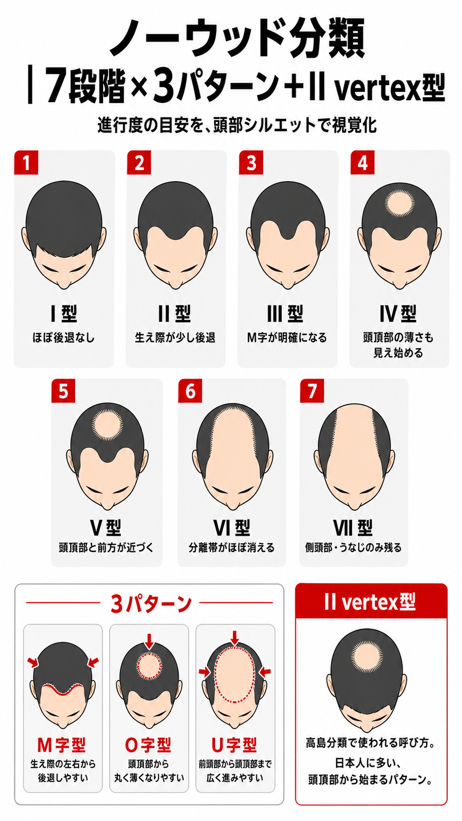 ノーウッド分類7段階×3パターン(M字・O字・U字)とII vertex型の進行度図解