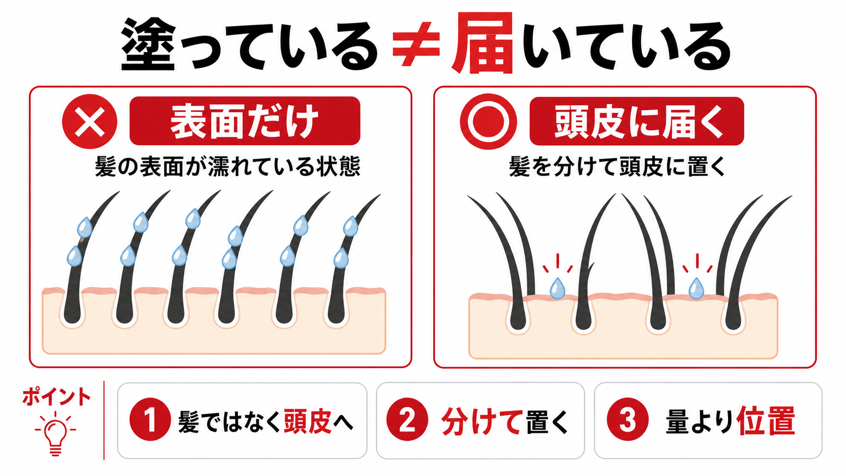 AGA外用薬の塗っている状態と頭皮に届いている状態の違いを比較した図解