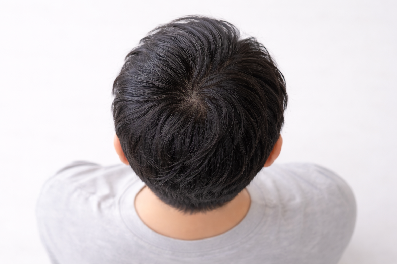 頭頂部のつむじ周辺の地肌が透けて見える状態をイメージした写真