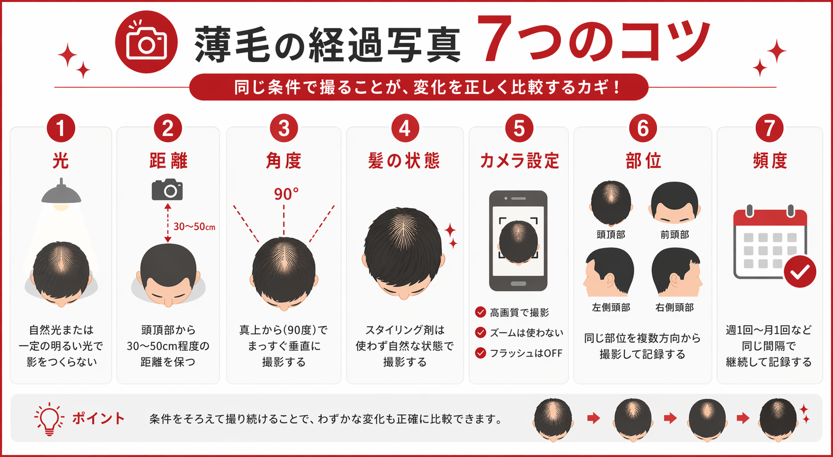 薄毛の経過写真を同条件で撮るための7つのコツを図解したインフォグラフィック