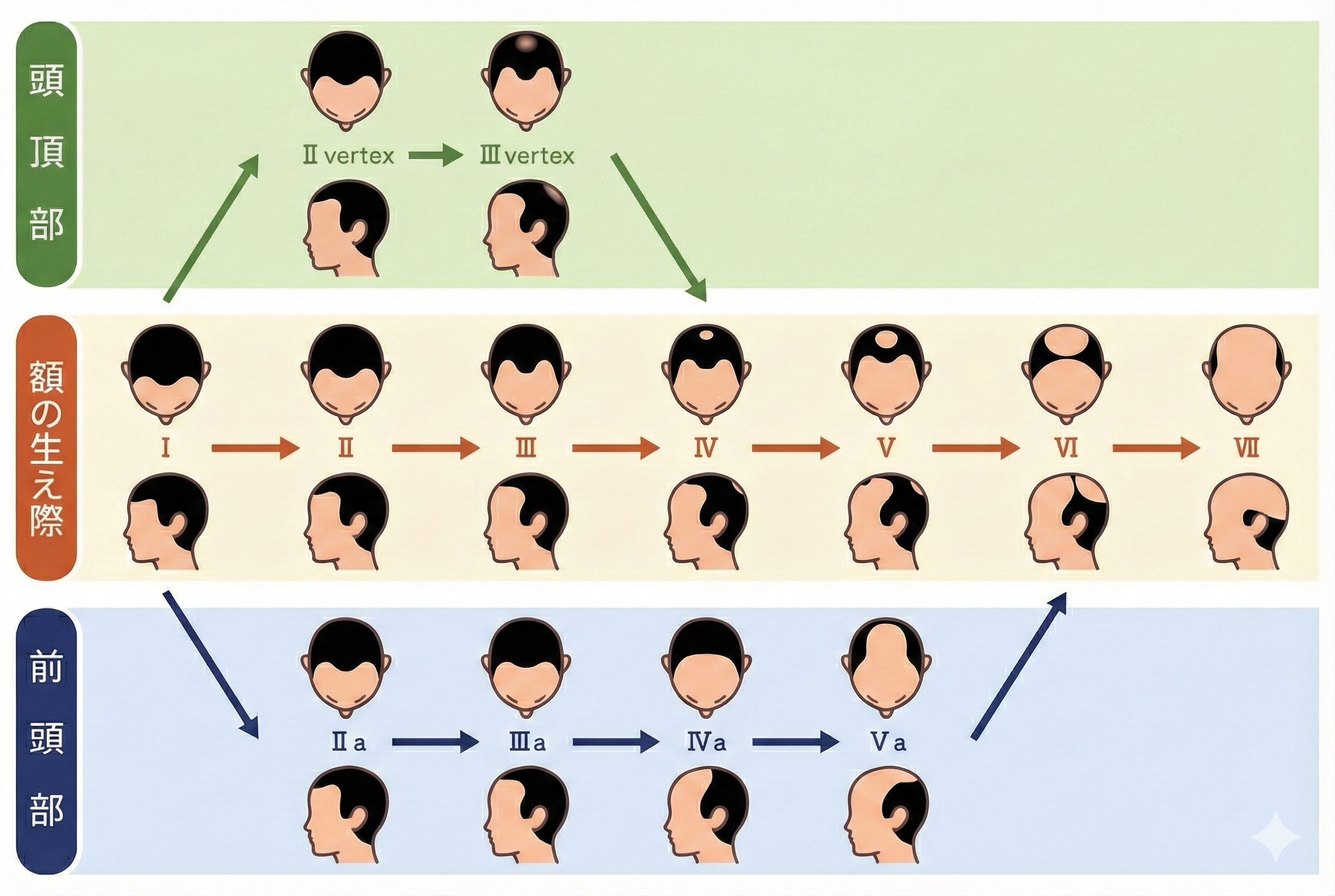 AGAの内服薬と外用薬の違いは?選び方の考え方を図解で整理 25 AGAの内服薬・外用薬の選び方の考え方(具体策)