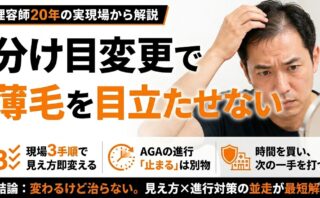 分け目を変えると薄毛は目立たない｜理容師20年の3手順と限界