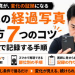薄毛の経過写真｜撮り方7つのコツと同条件で記録する手順【保存版】