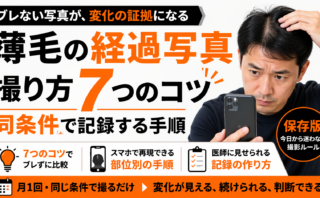 薄毛の経過写真｜撮り方7つのコツと同条件で記録する手順【保存版】