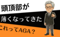 頭頂部が薄いのはAGA？今日からできる薄毛チェックと対処法は？
