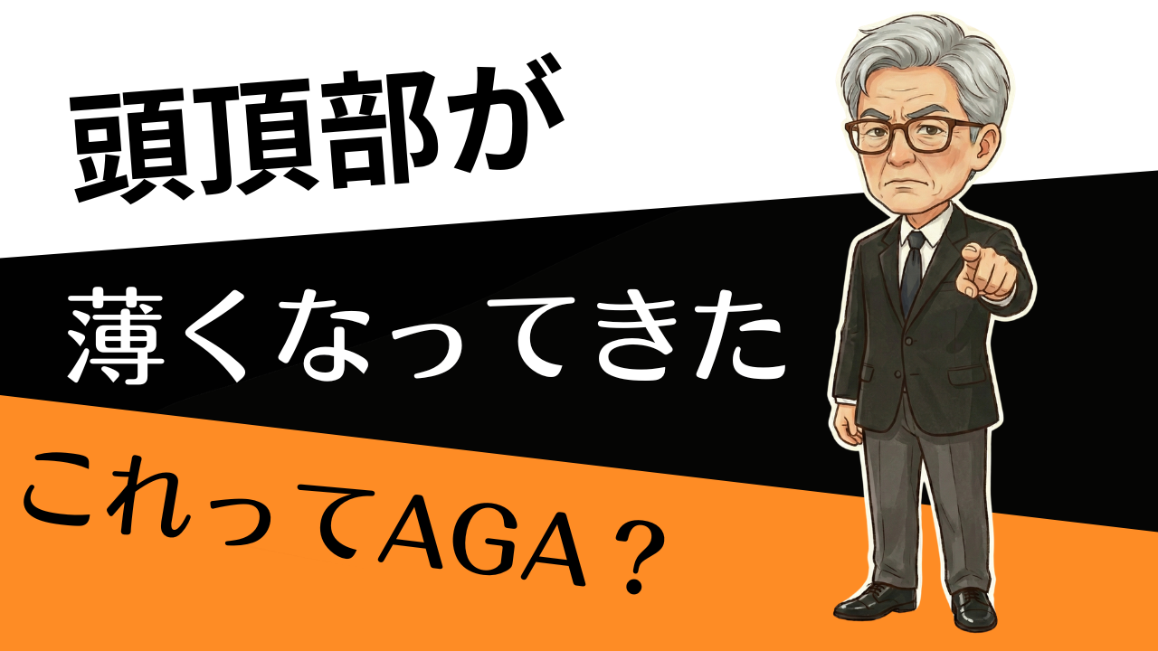 頭頂部が薄いのはAGA？今日からできる薄毛チェックと対処法は？