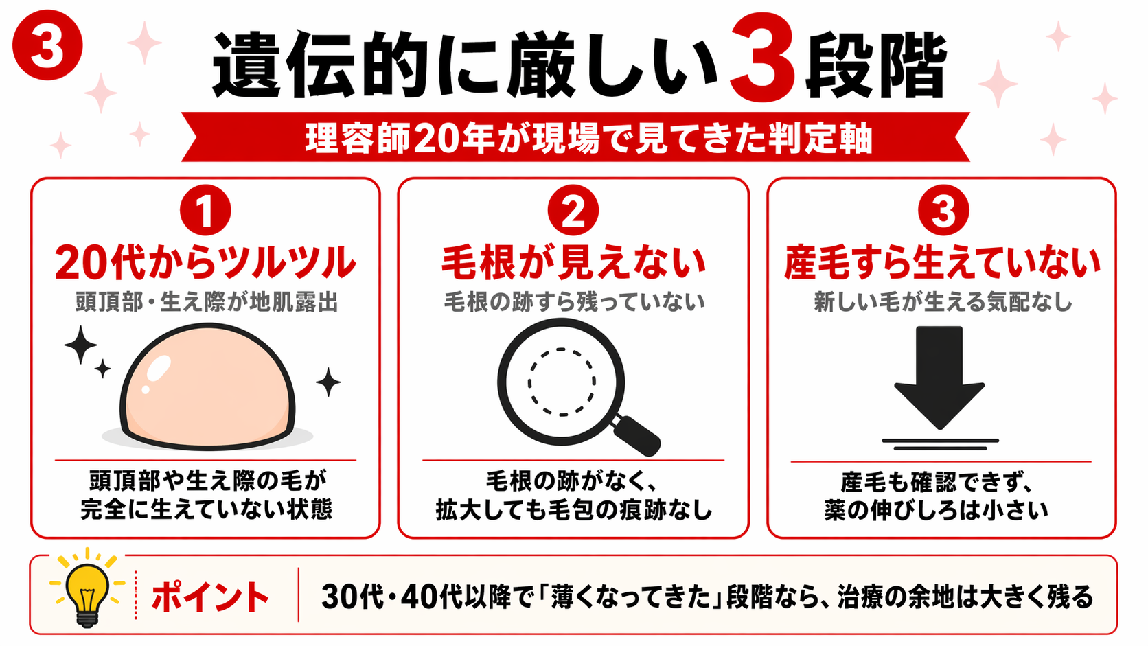 遺伝的に厳しい3段階の判定基準を3カードで示した図解。20代からツルツル・毛根が見えない・産毛すら生えていないの3段階。