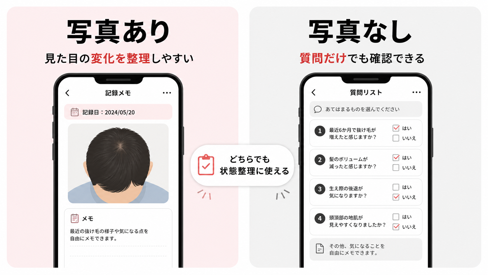 【AGA髪の状態チェックAI】とは?相談前に髪の状態を整理できるセルフチェックツール 19 AGA髪の状態チェックAIの写真ありと写真なしの使い方の違い
